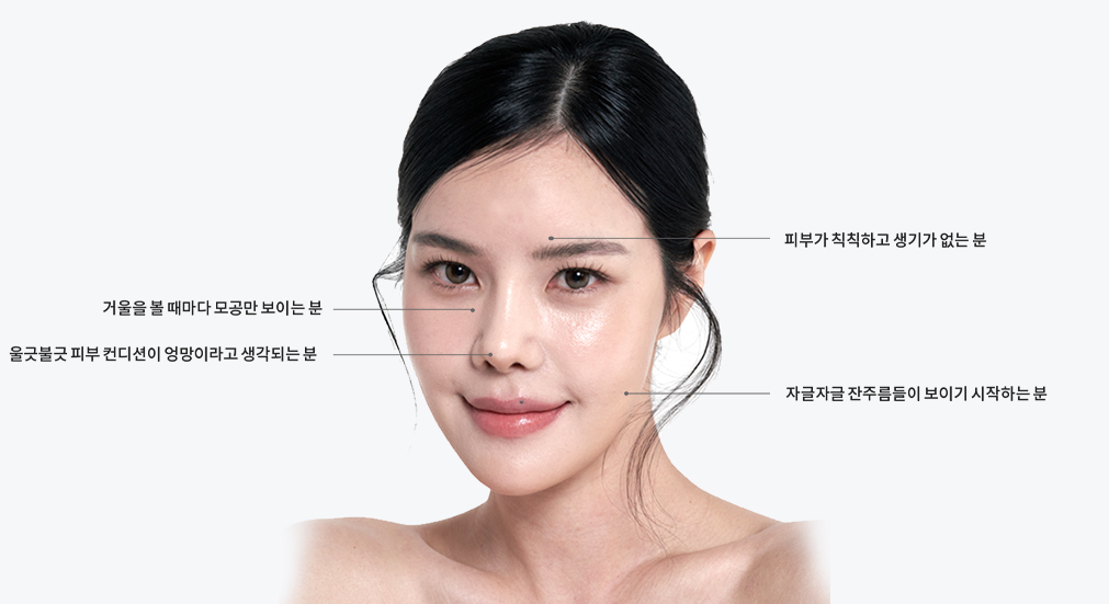 브이로 RM 시술부위 사진